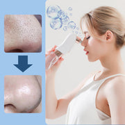 Electric Bubble Blackhead Remover Vacuum